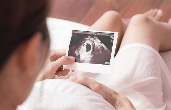 Doppler Feto-Placentario