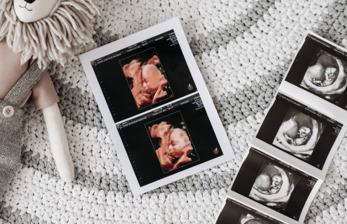 Ecografía 3D – 4D